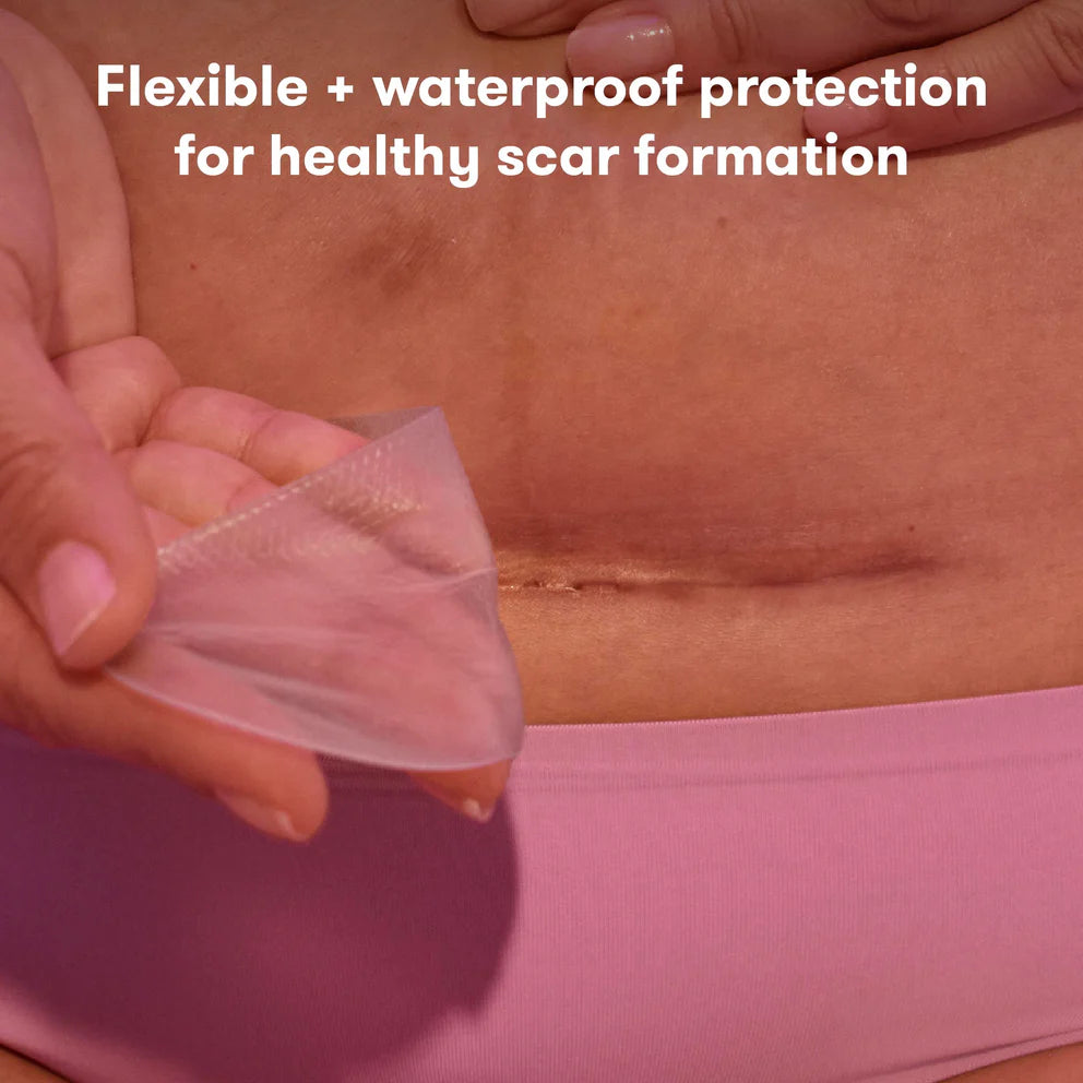 frida mom c-section silicone scar patches